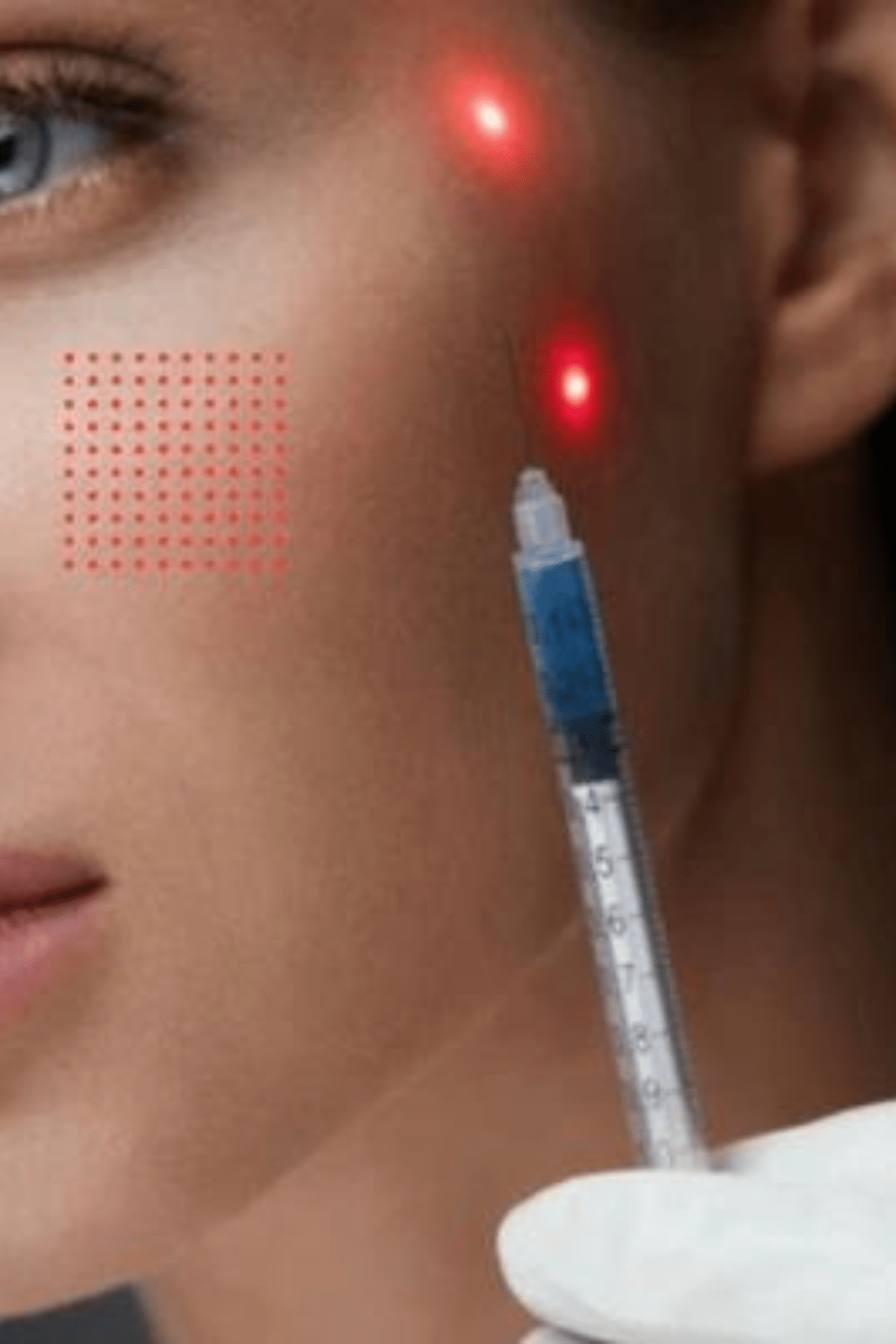 Rejuvenecimiento Facial y Corporal con Láser Endotisular: Descubre Avances Innovadores en Medicina Estética